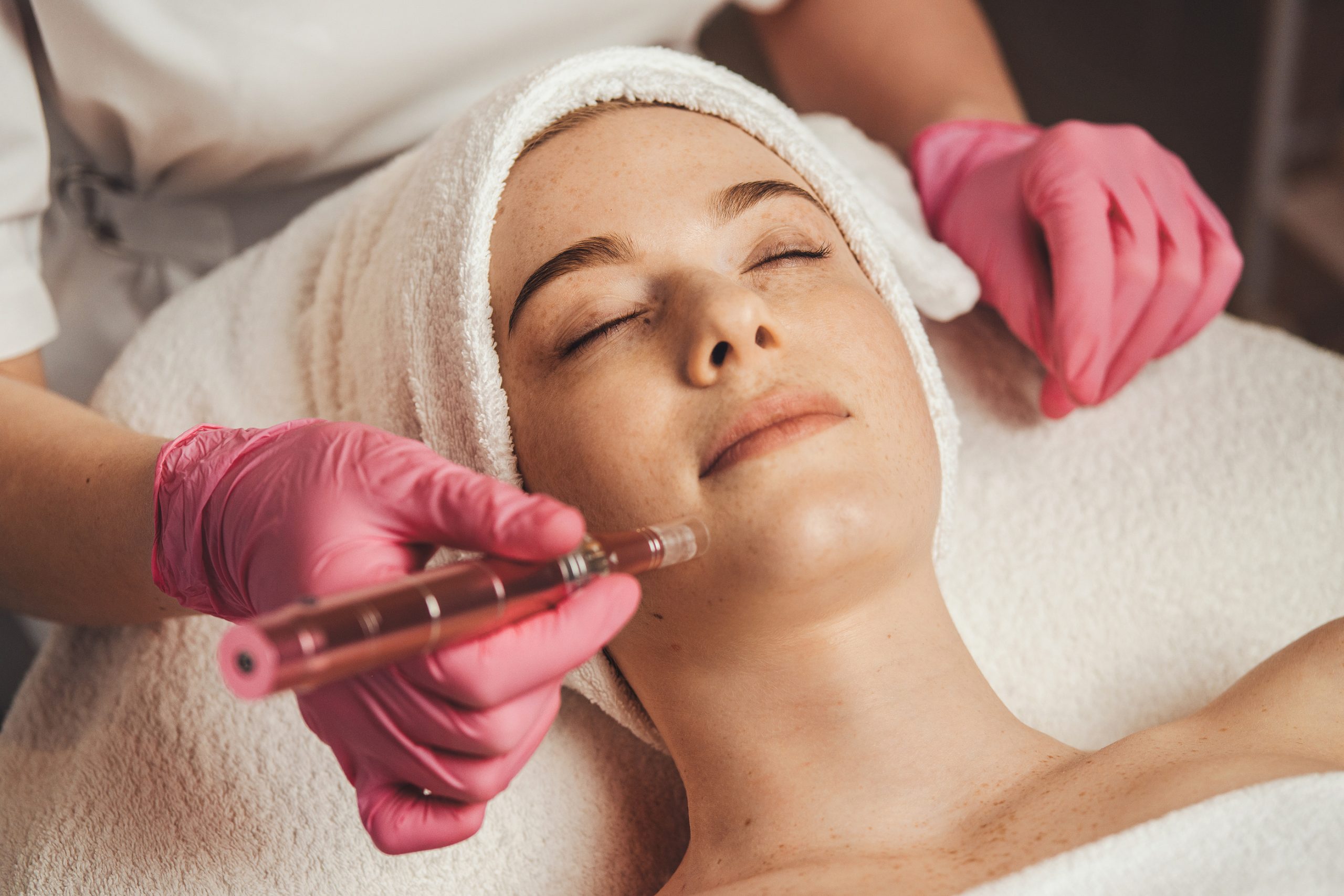 How Many Microneedling Sessions Do You Need for Best Results?